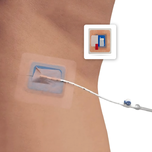 Dispositivo de sujeción para catéter de Drenaje